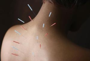how-does-acupuncture-work